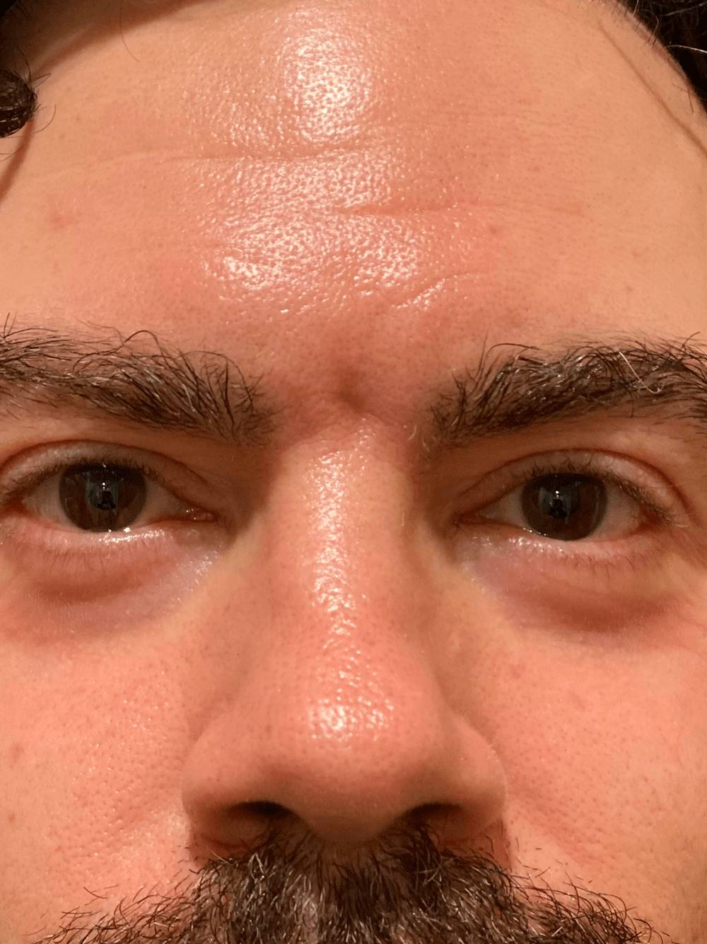 388485649-before.jpg